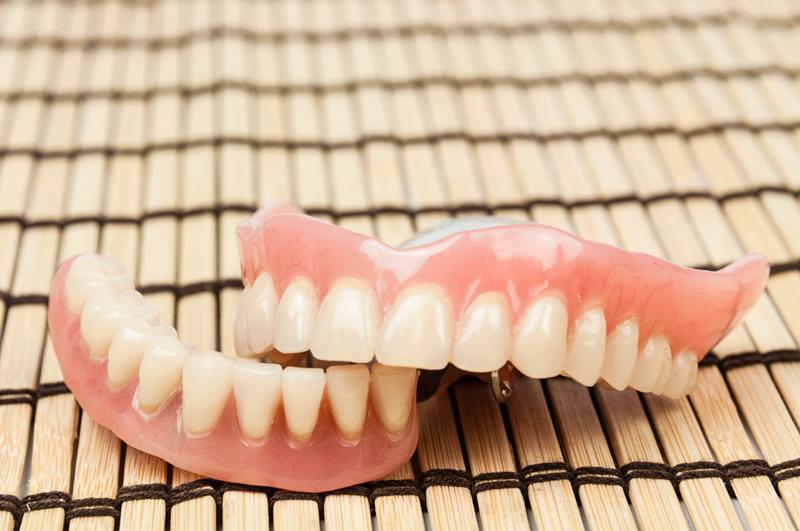 affordable dentures in Kelowna
