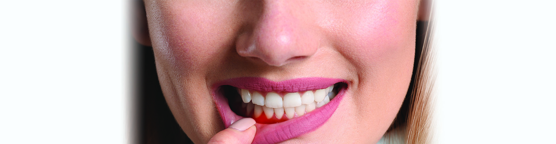 Dental gum and Filling Treatment In Kelowna